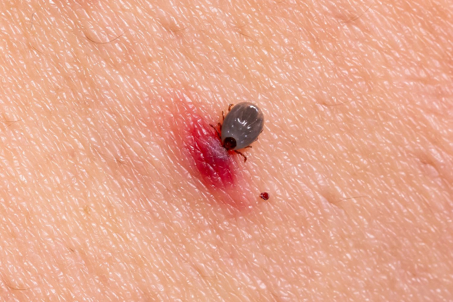 Närbild på en fästing.